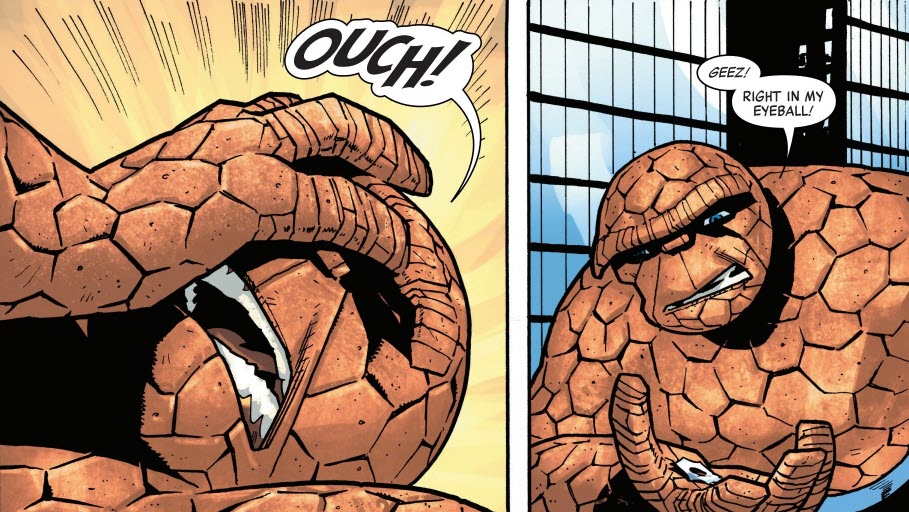 Ben Grimm hurts his eye fighting Bullseye in The Thing 2